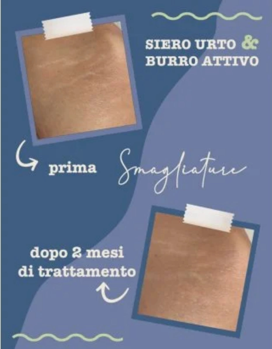 Burro attivo Smagliature 150ml