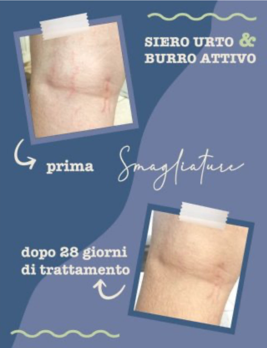 Siero Urto Smagliature 100ml